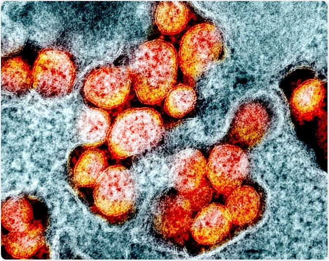 Novel Coronavirus SARS-CoV-2 Transmission electron micrograph of SARS-CoV-2 virus particles, isolated from a patient. Image captured and color-enhanced at the NIAID Integrated Research Facility (IRF) in Fort Detrick, Maryland. Credit: NIAID