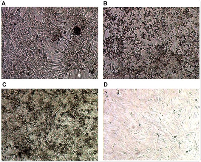 Typical images from cell culture in an in vitro system for SARS-CoV-2 culture. Top row shows controls: (A) Negative control Vero E6 cells in media; (B) Cytopathic effect (CPE) in Vero E6 cells spiked with Victoria/01/2020 SARS-CoV-2; Bottom row shows Vero E6 cells inoculated with 1/10 dilution of serum sample from sample VC12 (patient ID UKCOV040), that tested positive for SARS-CoV-2 RNA by RT-PCR; (C) Aberrant cellular effects at day 4 in a culture inoculated with VC12 at day 0; (D) Normal appearance of cells at day 7 inoculated with 1/10 dilution of the culture supernatant of the VC12-challenged culture, illustrated in (C).