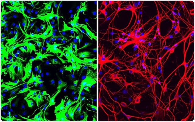 Left: mouse astrocytes (green) before reprogramming; Right: neurons (red) induced from mouse astrocytes after reprogramming with PTB antisense oligonucleotide treatment.