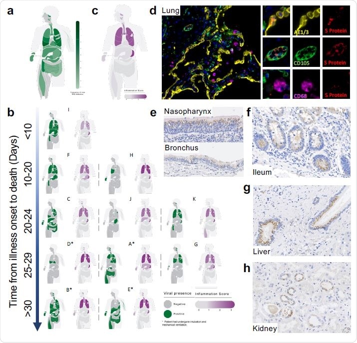 Mapping SARS-CoV-2 organotropism and cellular distribution in fatal Covid- 19 in relation to local inflammation. Distribution of SARS-CoV-2 RNA for all patients was determined by multiplex PCR (A; colour intensity denotes frequency of detectable RNA, dotted line on legend denotes maximal frequency within the patient cohort) (n=11). Distribution of individual patient viral RNA presence within organs plotted against time interval between illness onset and death compared with semi-quantitative score of organ specific inflammation for each patient (B). Severity of acute organ injury was assessed semi-quantitatively (0-3; no acute change (0) to severe organ injury/histological abnormality (3)) with aggregate scores visualised (C;