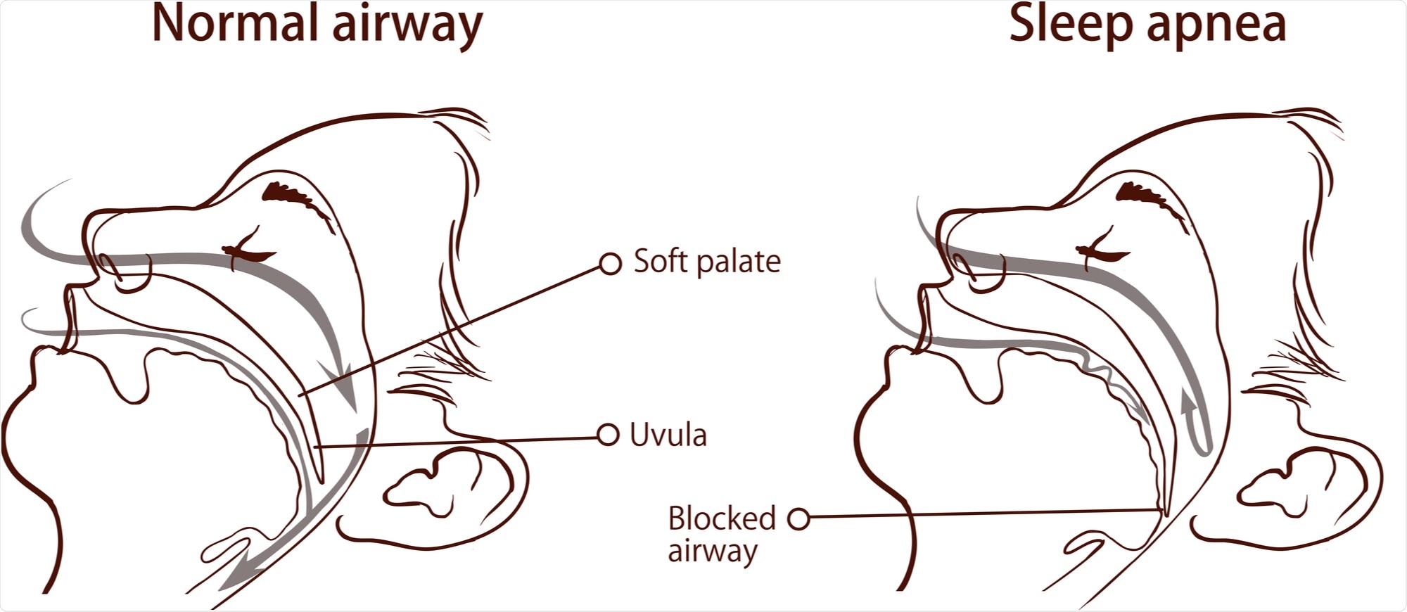 Image Credit: corbac40 / Shutterstock