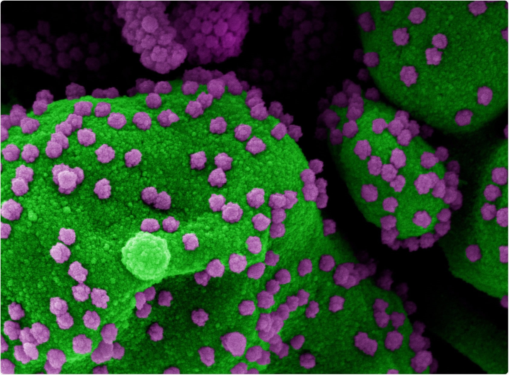 Study: Insights from a Pan India Sero-Epidemiological survey (Phenome-India Cohort) for SARS-CoV2. Image Credit: NIAID