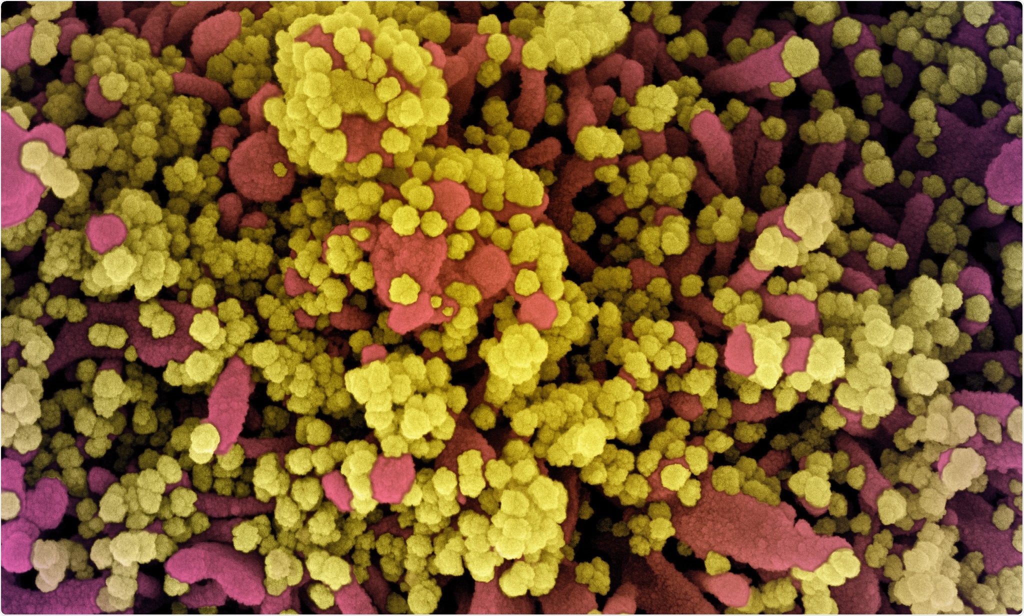 Study: Modular basis for potent SARS-CoV-2 neutralization by a prevalent VH1-2-derived antibody class. Image Credit: NIAID