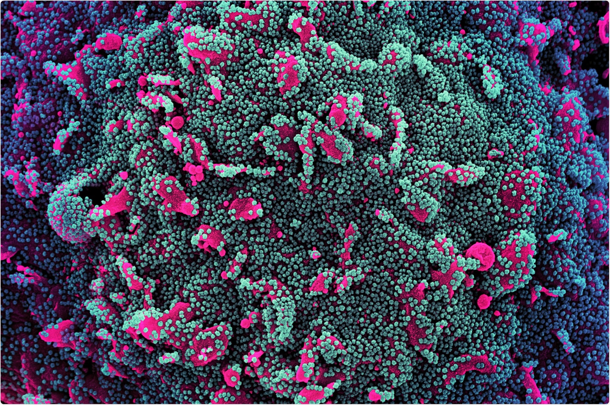 Study: A highly thermotolerant, trimeric SARS-CoV-2 receptor binding domain derivative elicits high titers of neutralizing antibodies. Image Credit: Mitand73 / Shutterstock