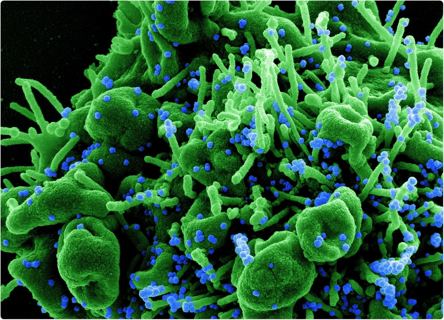 Study: Synthetic nanobody–SARS-CoV-2 receptor-binding domain structures identify distinct epitopes. Image Credit: NIAID