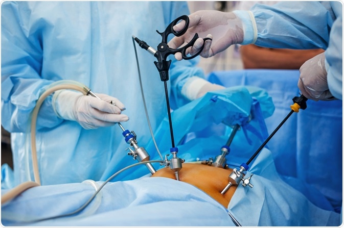 abdominal surgery