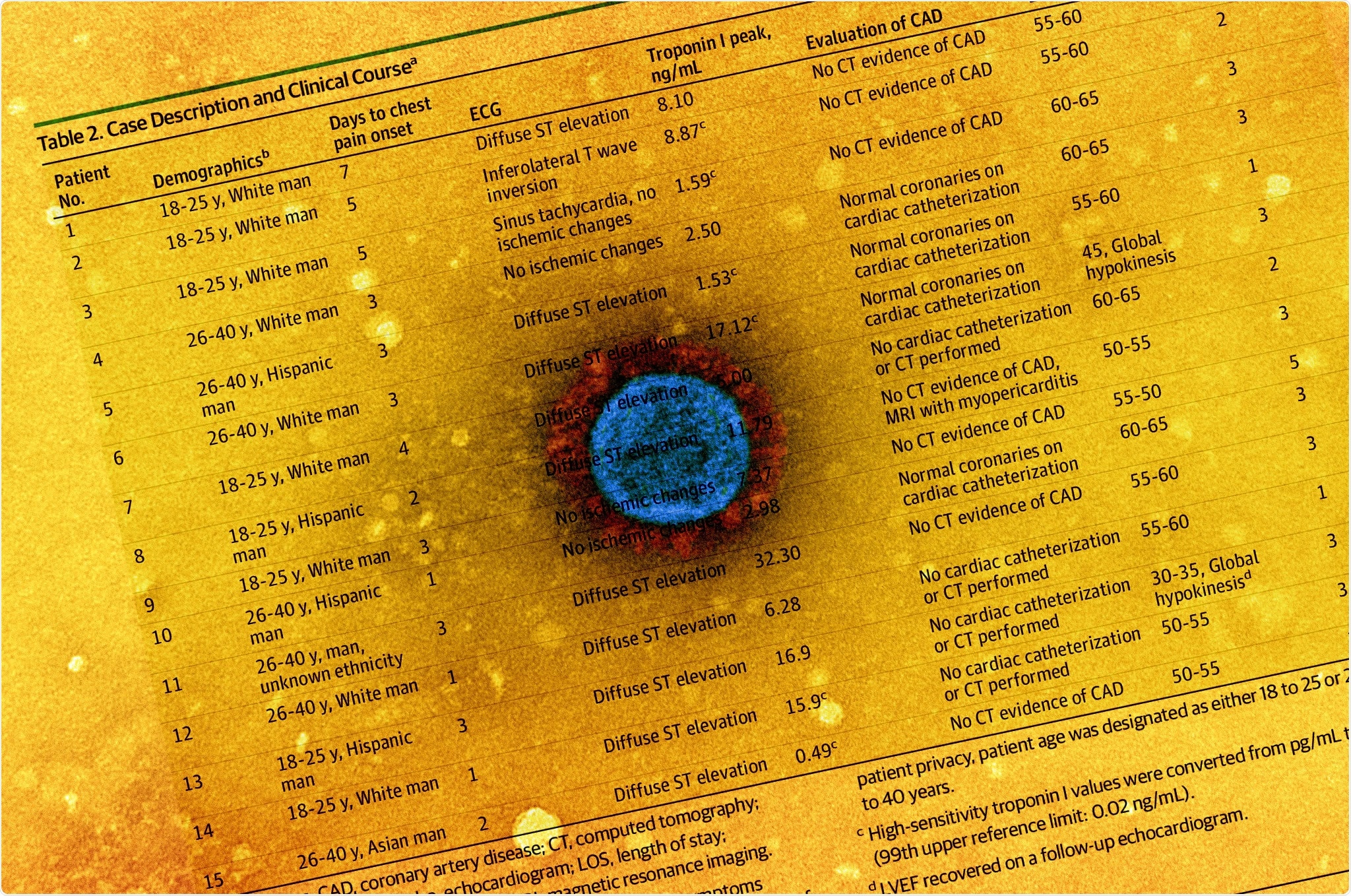 Research Letter: Acute Myocarditis Following COVID-19 mRNA Vaccination in Adults Aged 18 Years or Older. Image Credit: NIAID