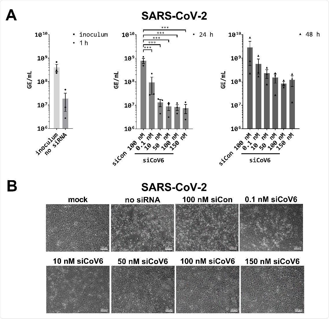 Inhibition of SARS‐CoV‐2 replication by siCoV6. (A) The replication of SARS‐CoV‐2 (BetaCoV/Munich/BavPat2‐ChVir984‐ChVir1017/2020) was investigated by quantitative RT‐PCR in Vero E6 cells. Vero E6 cells were transfected with 0.1–150 nM siCoV6 or 100 nM siCon and infected 24 h after transfection with SARS‐CoV‐2 at a MOI of 0.01. Subsequently, the cells were washed, supplemented media were added and viral RNA was isolated from the culture supernatant at 1 hpi, 24 hpi and 48 hpi. Genome equivalents per mL (GE/mL) were determined by quantitative RT‐PCR. The mean ± SEM of three independent experiments is shown. The statistical significance was determined by a univariate analysis of variance (one‐way ANOVA); ***p <0.001. (B) Cell morphology observation. Cells were fixed 48 h after infection with SARS‐CoV‐2 and the cytopathic effect (CPE) of viral infection was documented by transmitted light microscopy. Representative data from three independent experiments are shown. Scale bar: 200 μm.