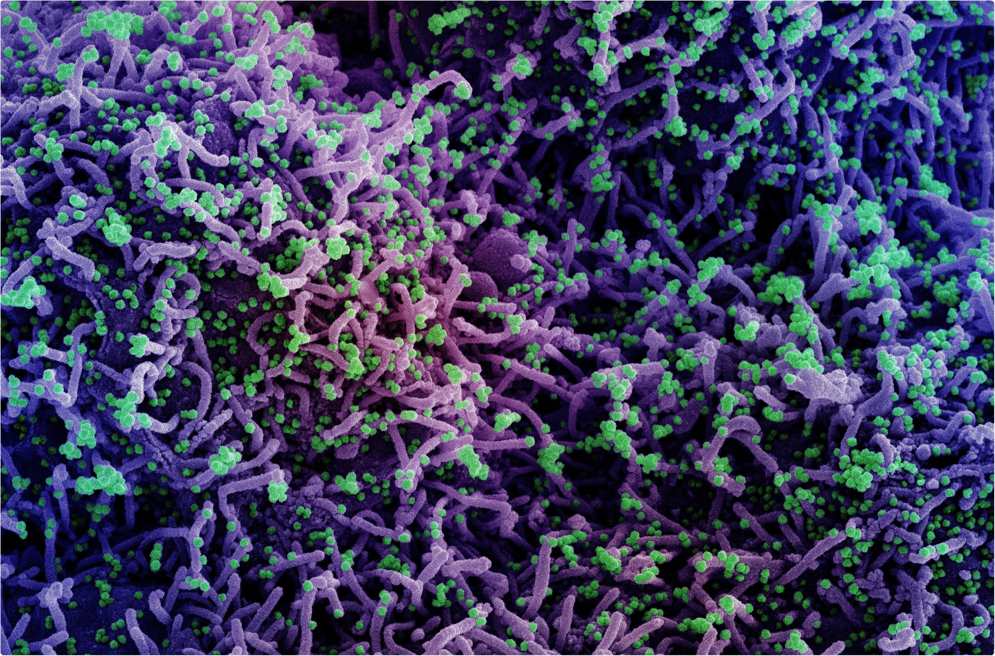 Study: The Chaotic Behavior of the Spread of Infection During the COVID-19 Pandemic in the United States and Globally. Image Credit: NIAID
