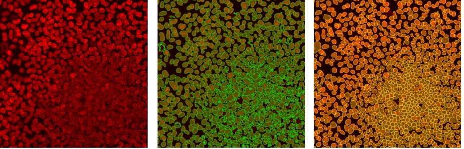 Accurate object segmentation: raw data (left), standard threshold (middle), TrueAI instance segmentation (right). Instance segmentation reliably separates difficult-to-distinguish objects that are very close together, such as cells or nuclei in colonies or tissue.