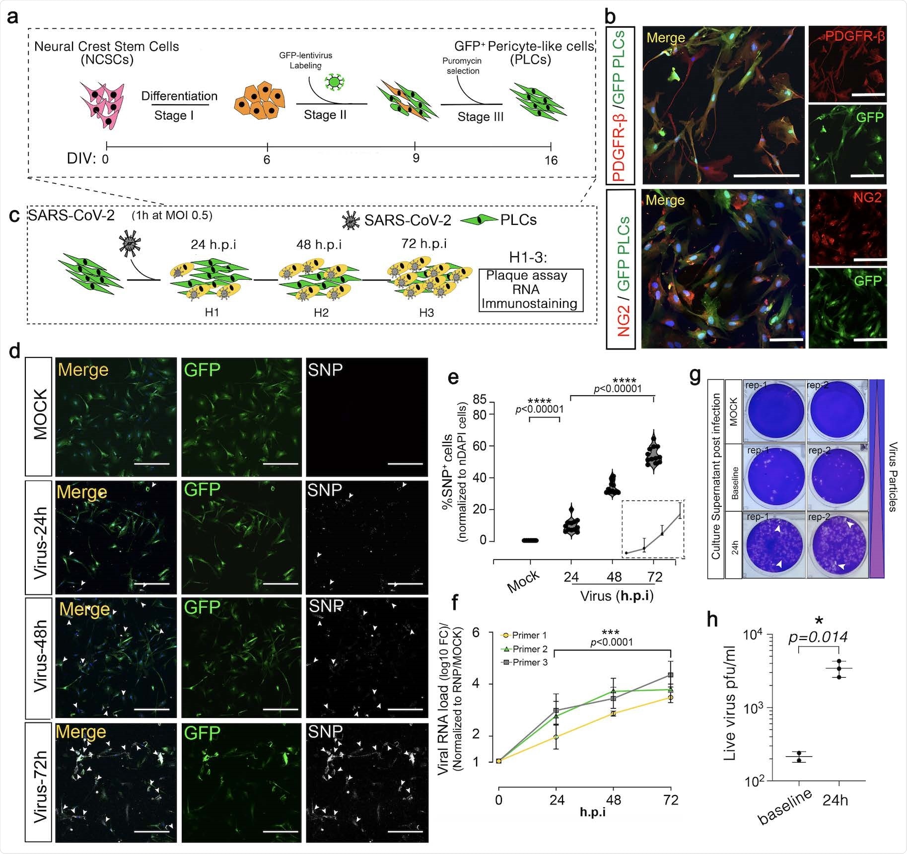 SARS-CoV-2 productively infects pericyte-like-cells.
