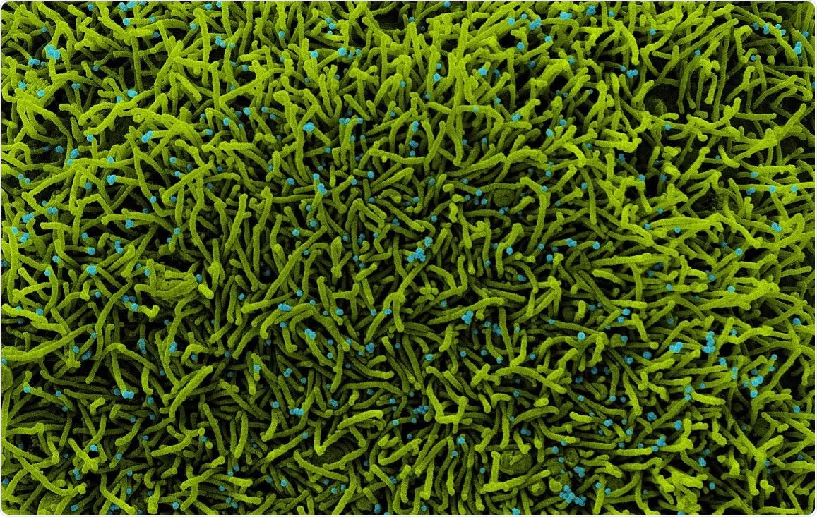 A CCL-81 cell (green) infected with SARS-CoV-2 virus particles, which are the small spherical structures (teal). The string-like protrusions extending from the cell are cell projections or pseudopodium, whose primary purposes are cell mobility and ingestion of nutrients. Image captured at the NIAID Integrated Research Facility (IRF) in Fort Detrick, Maryland.