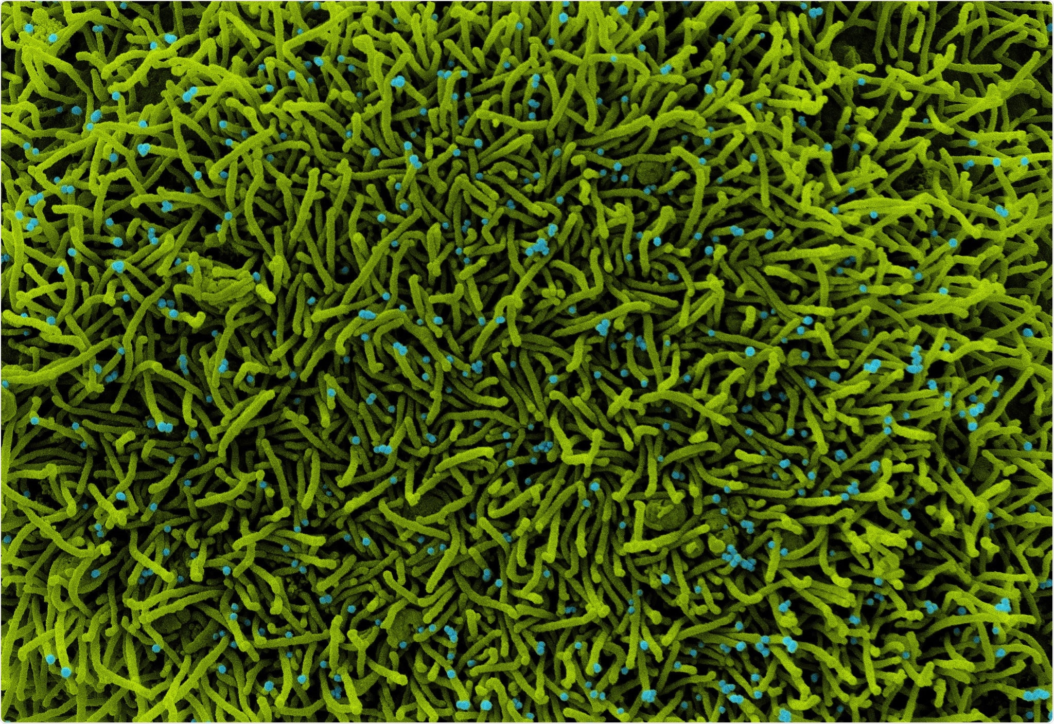 Study: Host-virus chimeric events in SARS-CoV2 infected cells are infrequent and artifactual. Image Credit: NIAID