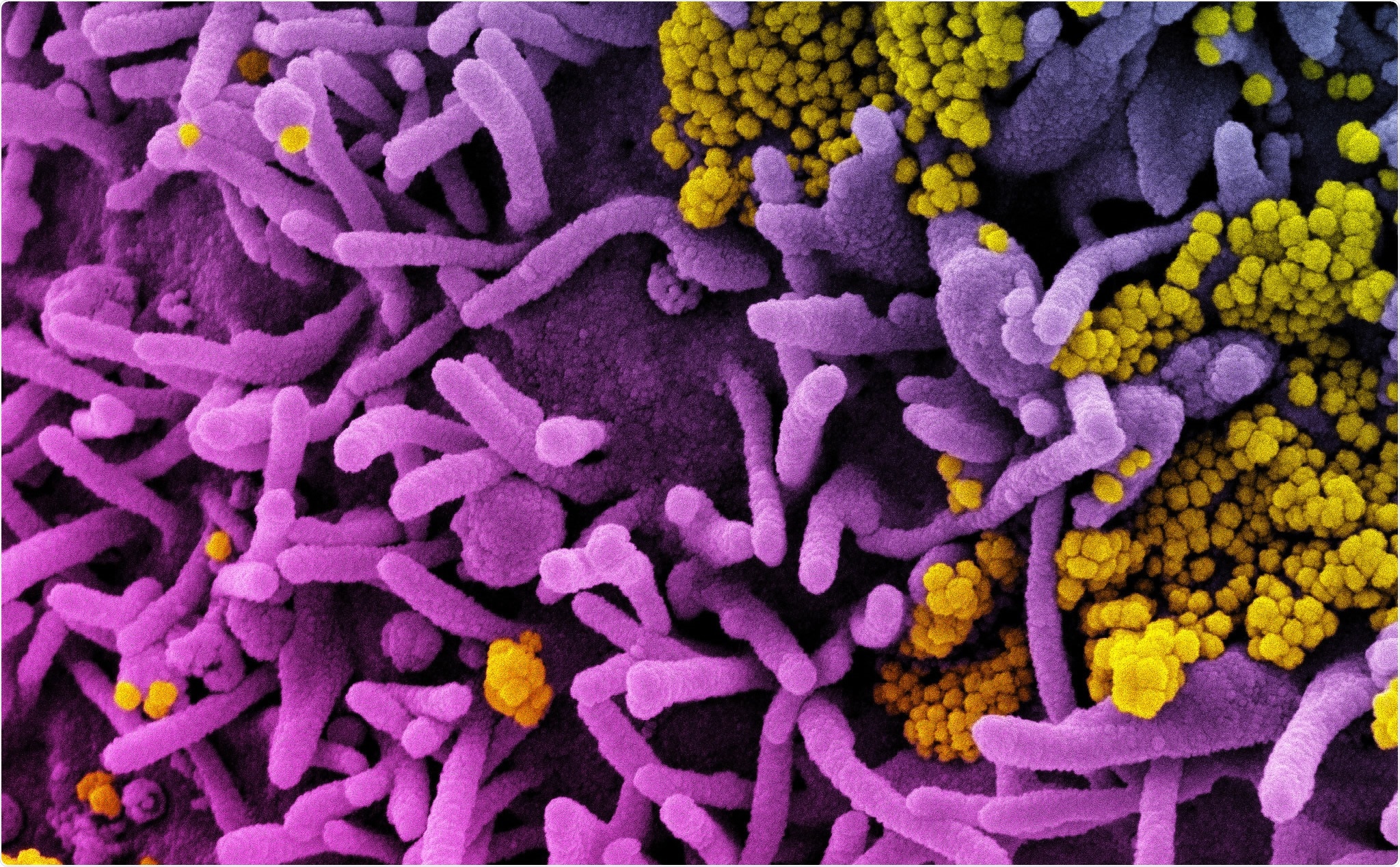 Study: Delivery of recombinant SARS-CoV-2 envelope protein into human cells. Image Credit: NIAID