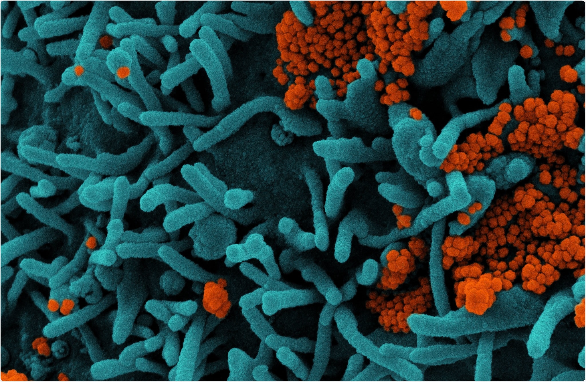 Study: Neutralizing antibody responses 10 months after mild and moderately-severe SARS-CoV-2 infection. Image Credit: NIAID
