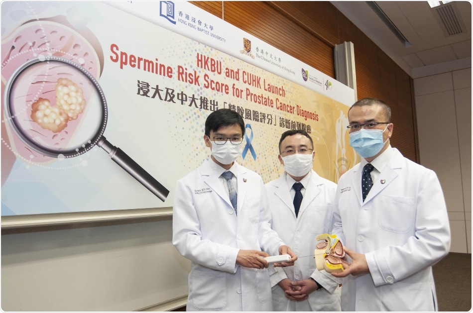 HKBU and CUHK jointly develop Spermine Risk Score for diagnosis of prostate cancer