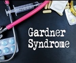 Gardner Syndrome Symptoms