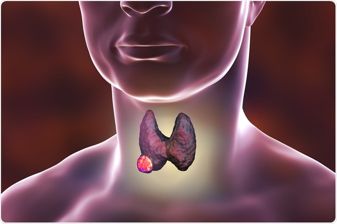 Image Credit: Kateryna Kon / Shutterstock