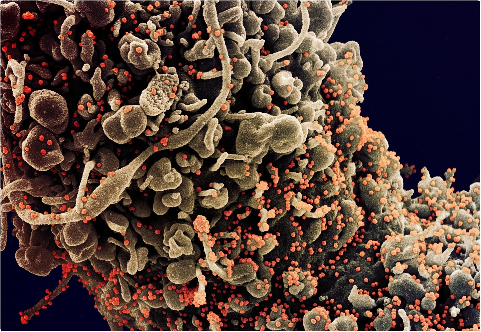 Study: Heightened COVID-19 Vaccine Response Following SARS-CoV-2 Infection. Image Credit: NIAID