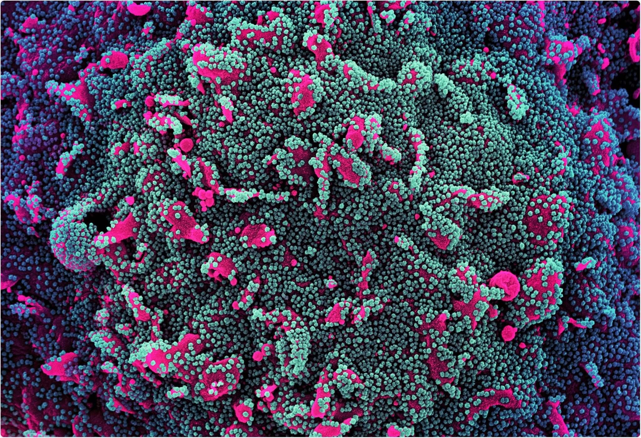 Technical report: Risk of SARS-CoV-2 transmission from newly-infected individuals with documented previous infection or vaccination