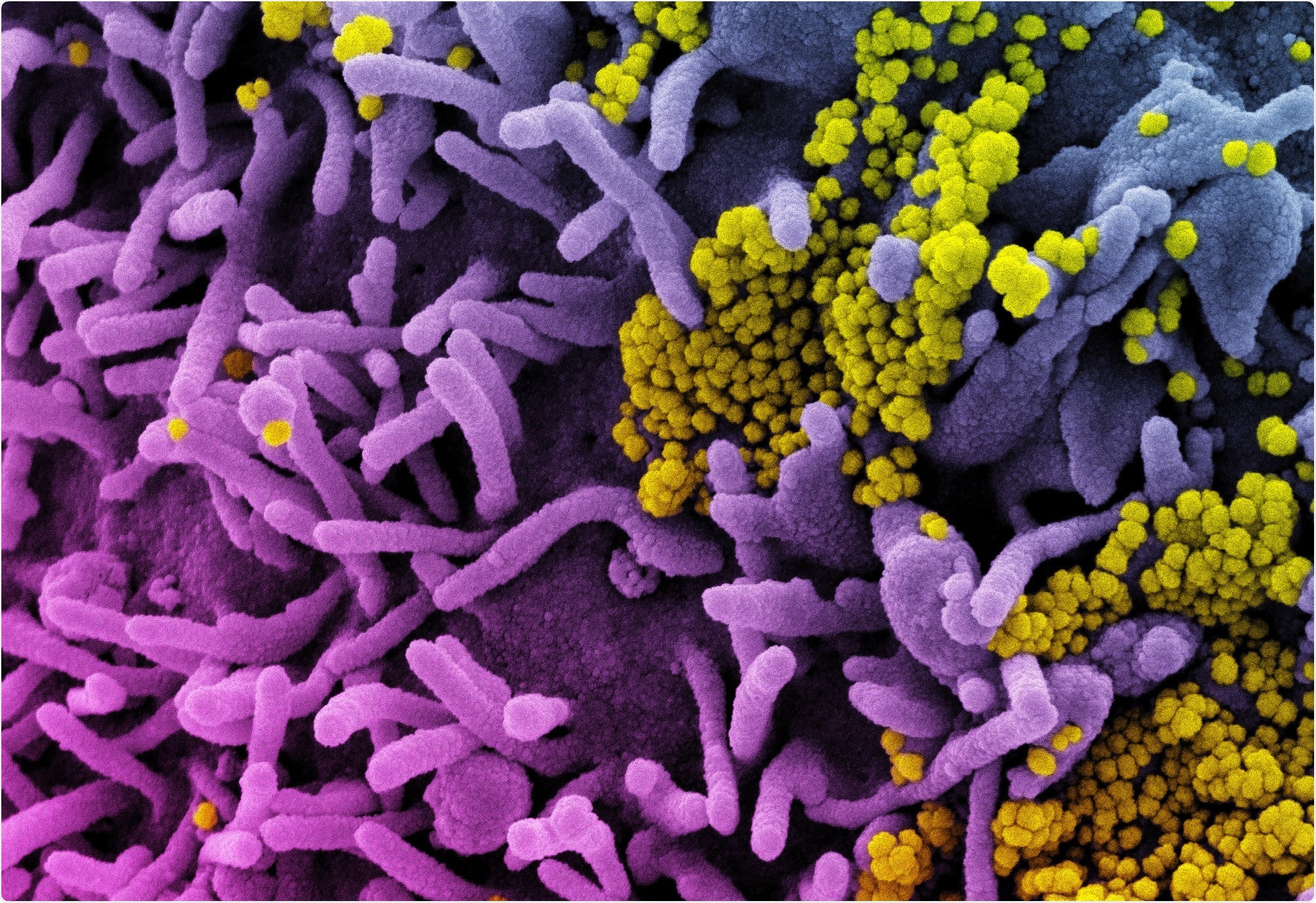 Study: Memory B cell repertoire for recognition of evolving SARS-CoV-2 spike. Image Credit: NIAID