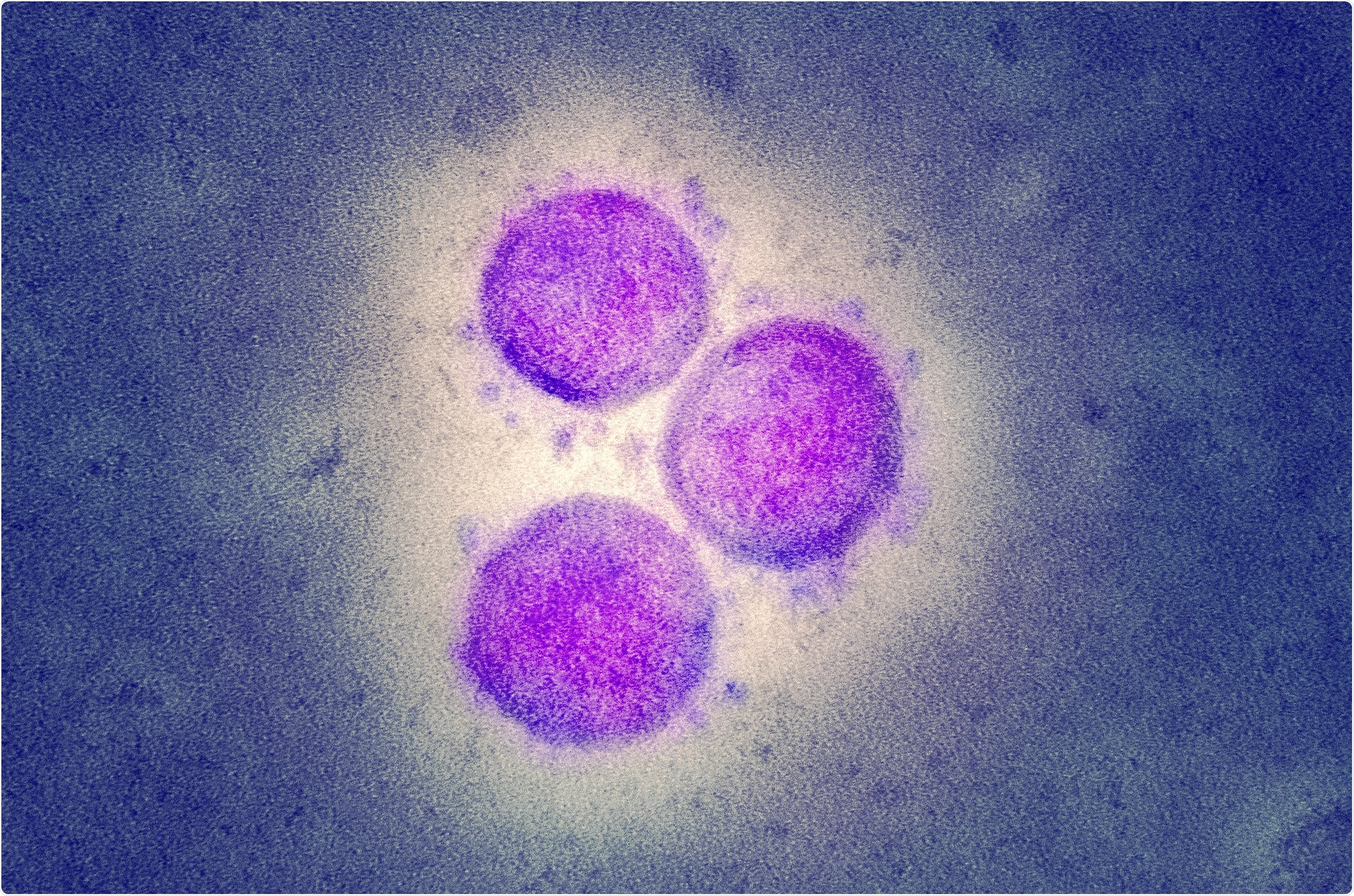 Study: Genome-Wide Covariation in SARS-CoV-2. Image Credit: NIAID