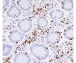 Using Bethyl Laboratories Antibodies to Improve T-Cell Marker Research