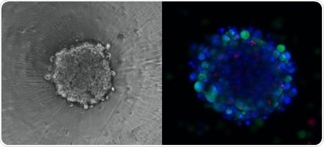 3D Spheroid with Immunostaining.