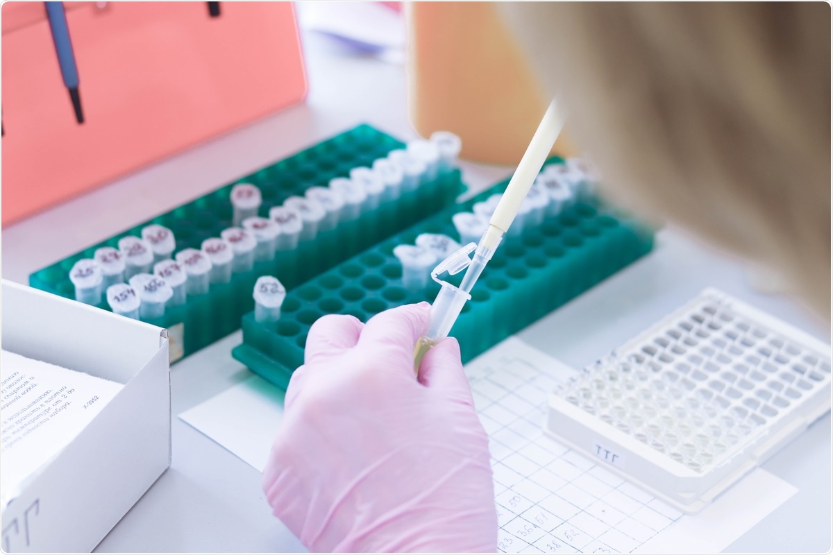 Study: Persistence and detection of anti-SARS-CoV-2 antibodies: immunoassay heterogeneity and implications for serosurveillance. Image Credit: Tati9 / Shutterstock