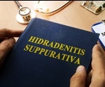 Hidradenitis Suppurativa Causes
