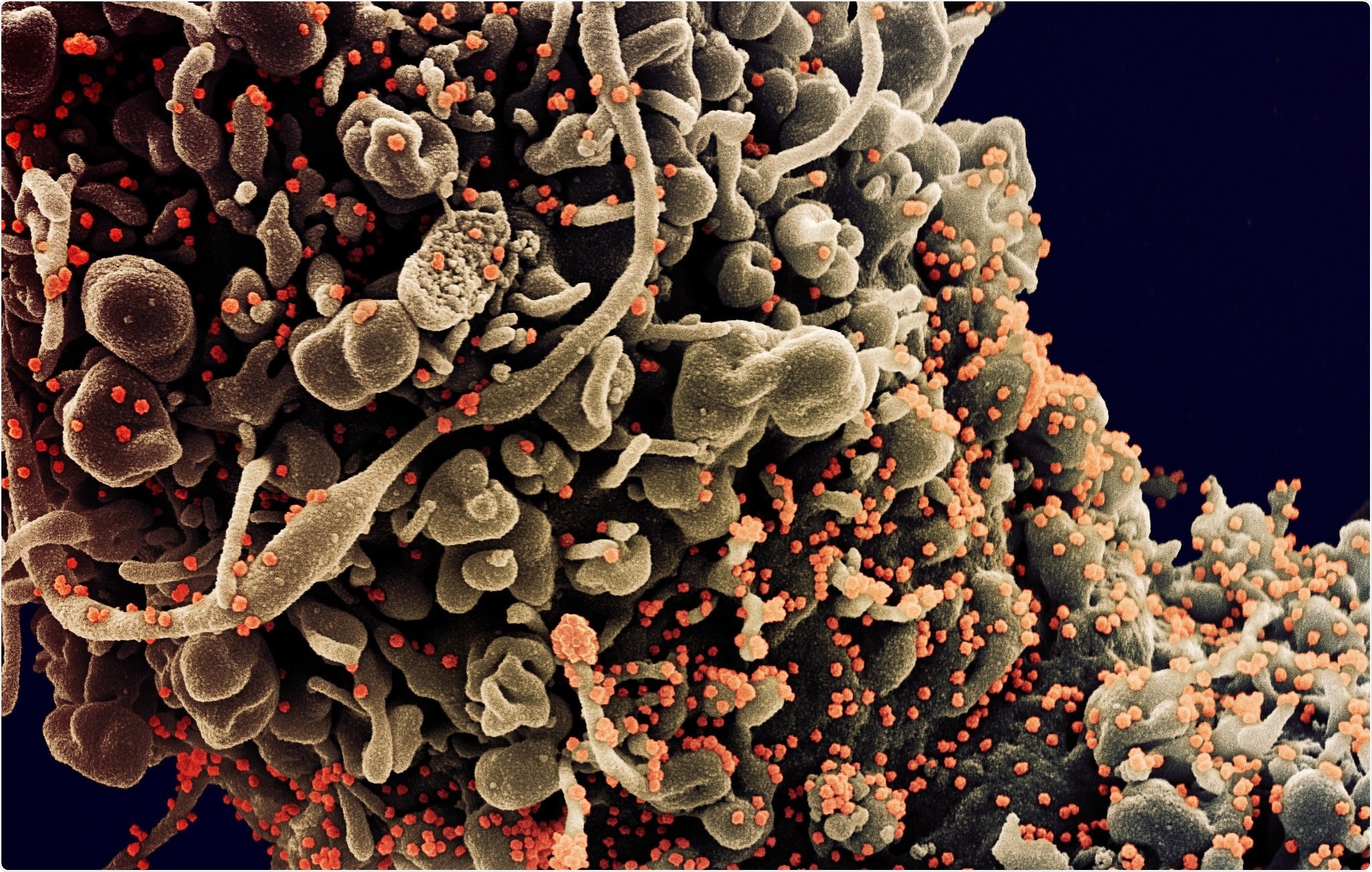 Study: Antibody and T cell responses to a single dose of the AZD1222/Covishield vaccine in previously SARS-CoV-2 infected and naïve health care workers in Sri Lanka. Image Credit: NIAID