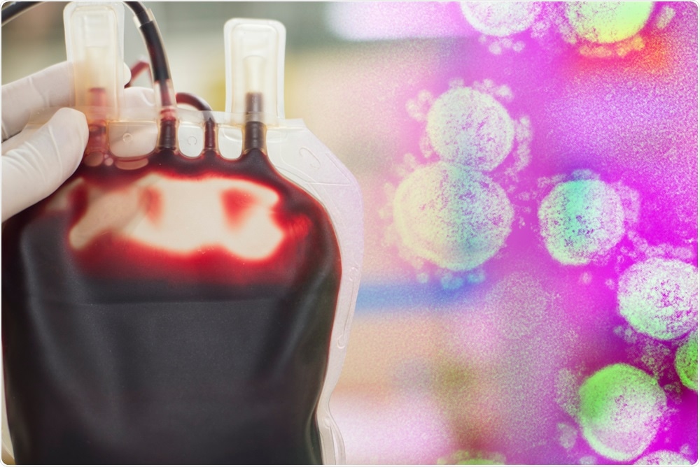 Study: Systematic review of the association between ABO blood type and COVID-19 incidence and mortality. Image Credit: Schira / Shutterstock