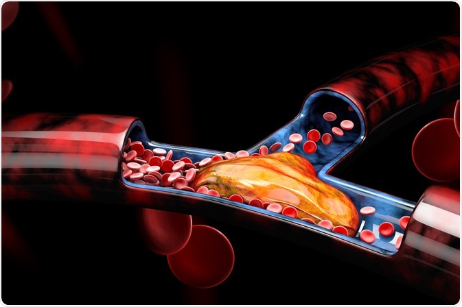 Image Credit: Victor Josan / Shutterstock