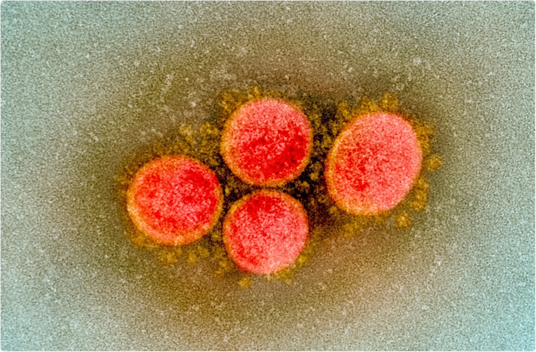 Study: SARS-CoV-2 variant B.1.617 is resistant to Bamlanivimab and evades antibodies induced by infection and vaccination. Image Credit: NIAID
