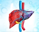 Types of Liver Cancer