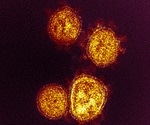 Study suggests vitamin B12 as a SARS-CoV-2 antiviral