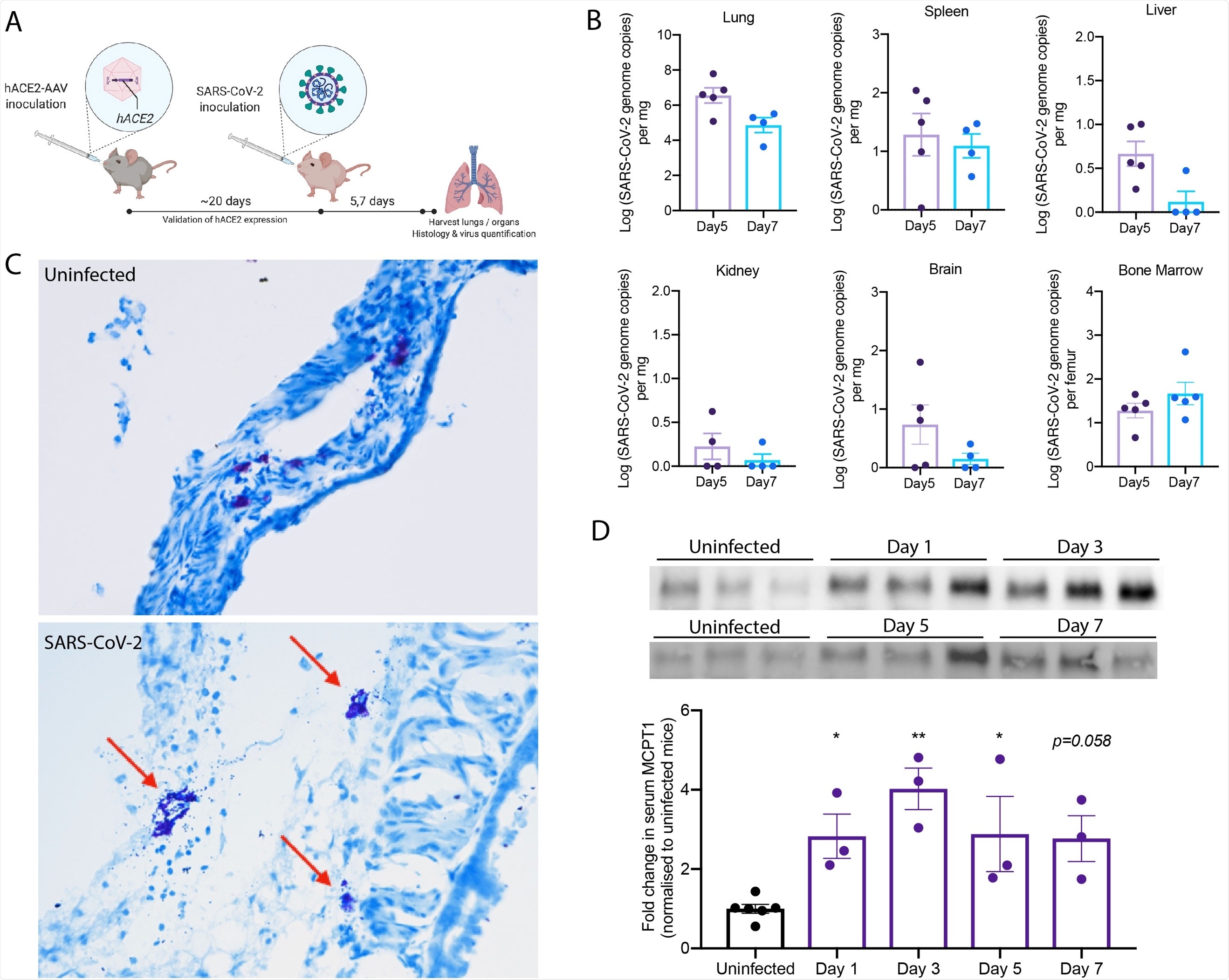Degranulation of MCs in SARS-CoV-2 infected mice. (A) C57BL/6 mice were inoculated intranasally with hACE2-AAV to induce hACE2 expression in the airways. SARS-CoV-2 (2x107 TCID50) TCID-50) was inoculated intranasally into hACE2-AAV C57BL/6 mice. Blood was taken on days 1, 3, 5, and 7, and organs were harvested after 5 or 7 days for histology and virus quantification. (B) Virus quantification from the organs harvested shows detection in the lung, spleen, liver, kidney, brain, and bone marrow both Days 5 and 7. (C) Histology images of toluidine blue-stained trachea sections from uninfected and SARS-CoV-2 infected mice. Degranulating MCs (red arrow) could be observed in SARS-CoV-2 infected mice as well as tissue edema and airway narrowing. (D) Western blot images after chymase detection in serum Days 3, 5 and 7 post-infection shows systemic elevation of chymase, which was quantitated by densitometry from 3 individual mouse samples and presented as fold-increase over uninfected controls. Error bars represent the SEM. Chymase was significantly elevated in serum of infected mice compared to uninfected controls, determined by 1-way ANOVA with Dunnett’s post-test; *p<0.05, **p<0.01. Nonsignificant p-values below