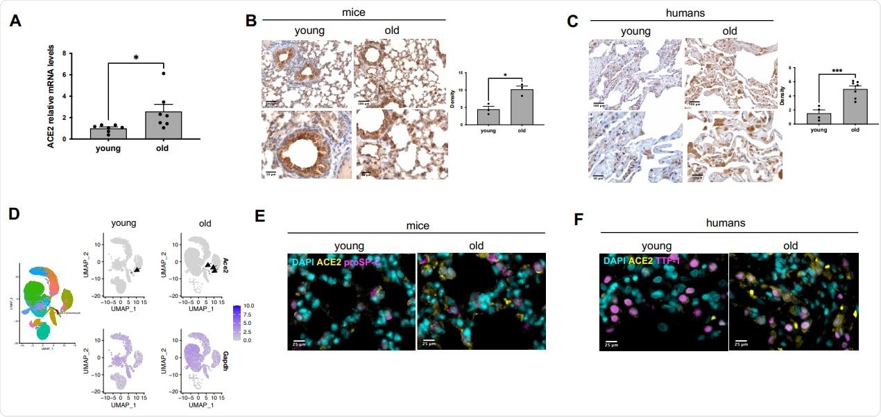 ACE2 expression increases during ageing in mouse and human lungs