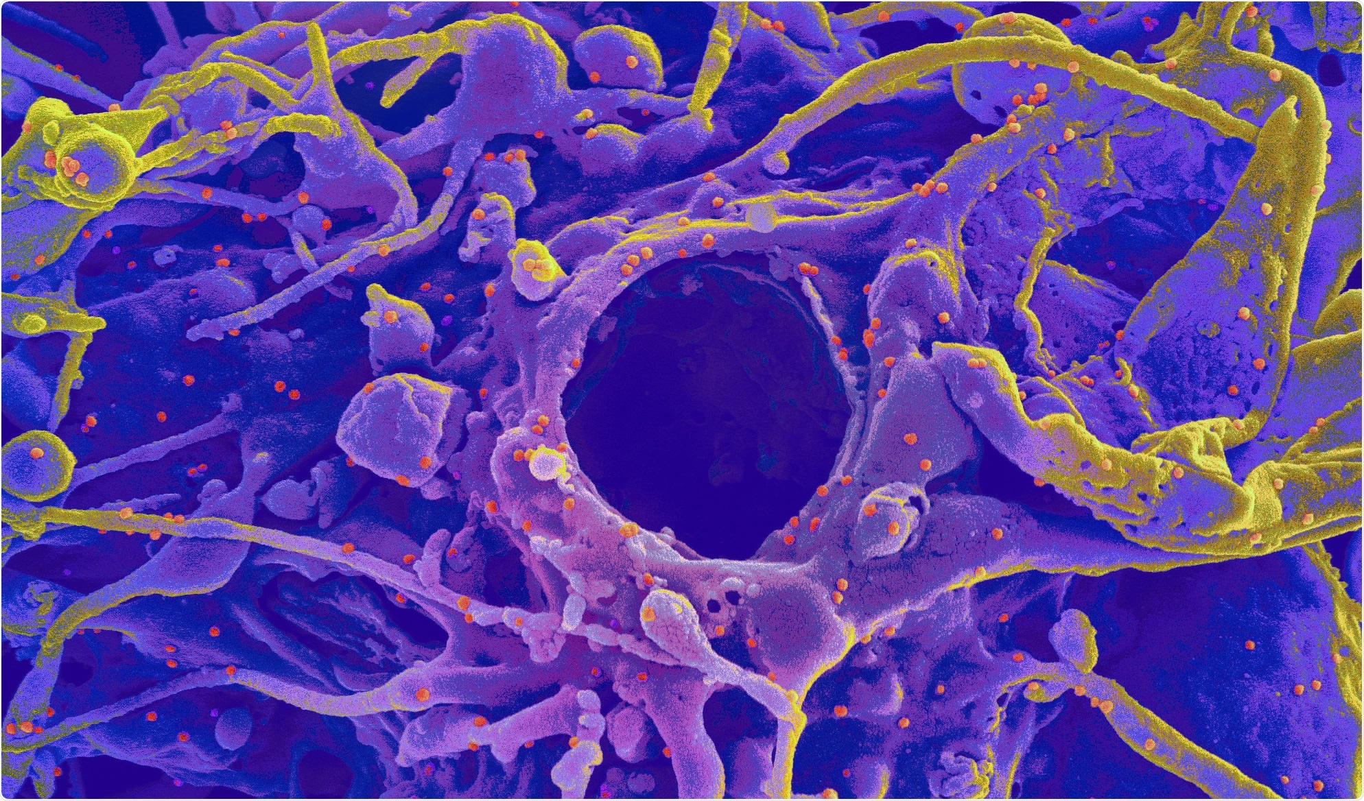 Study: Recurrent emergence of SARS-CoV-2 spike deletion H69/V70 and its role in the Alpha variant B.1.1.7. Image Credit: NIAID