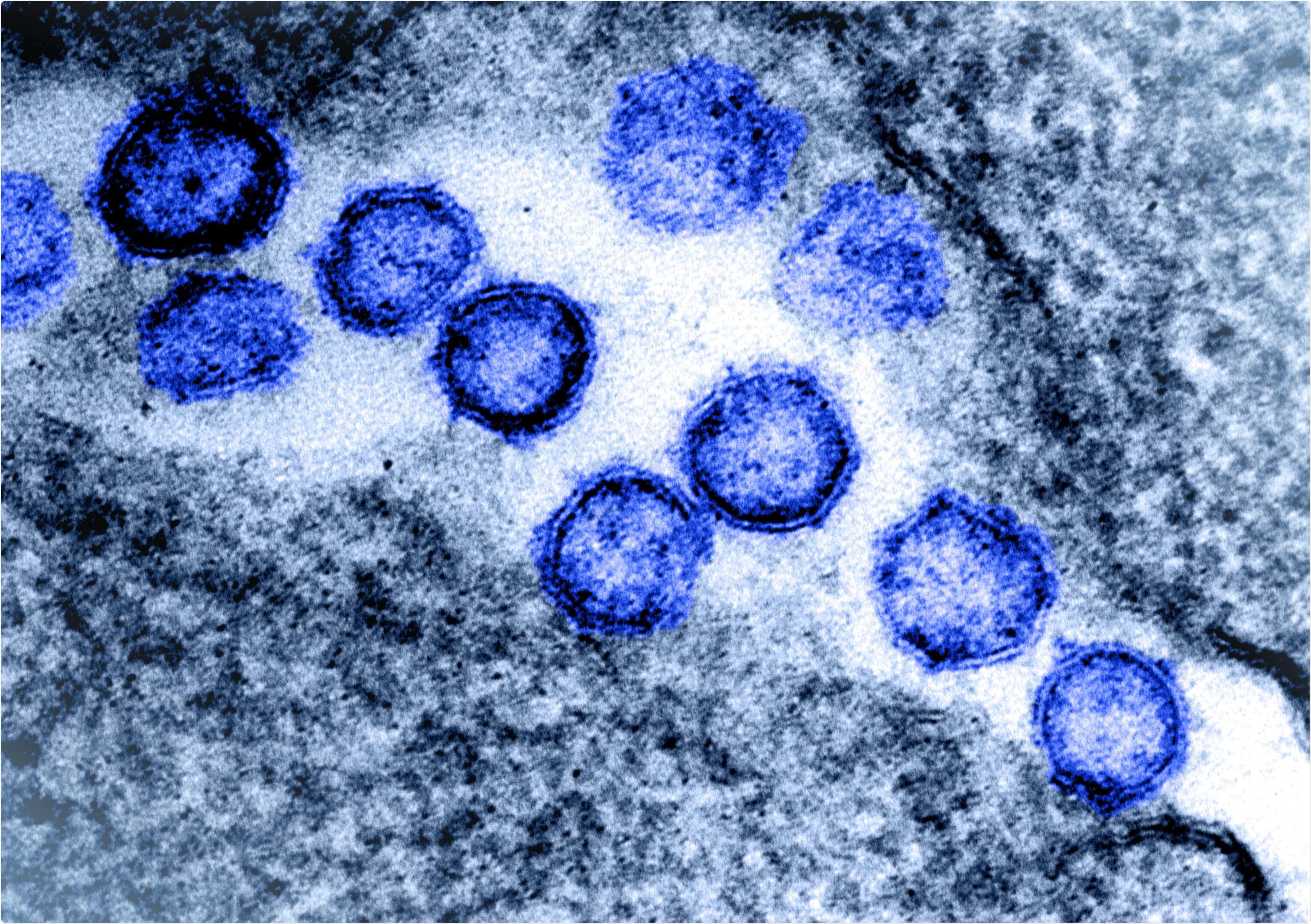 Study: Emergence of immune escape at dominant SARS-CoV-2 killer T-cell epitope. Image Credit: NIAID
