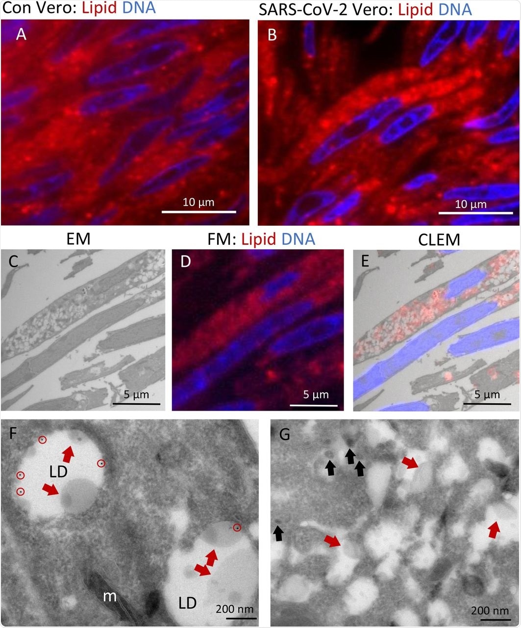 Lipid accumulates in e-lucent compartments more densely in infected Vero cells. Fluorescence microscopy of DNA and lipid staining with Nile red in A) the uninfected control (Con) Vero cells and B) cells infected with SARS-CoV-2 for 24 hours; C) Electron microscopy of infected cells; D) Fluorescence microscopy of the same cells, and E) Correlative light-electron microscopy (CLEM) showing lipid staining at e-lucent compartments in the electron microscope. Immuno-EM labelling for lipid droplet marker perilipin-2 in F) uninfected Vero cells and G) cells infected with SARS-CoV-2 for 24 hours. Blue color in A, B, D, and E shows the nuclei stained with Hoechst and red shows the lipids stained with Nile red. In electron micrographs, lipid like structure is denoted by red arrows, virus particles by black arrows, immuno-gold labelling of perilipin-2 by red circles, mitochondria by m, and lipid droplets by LD.