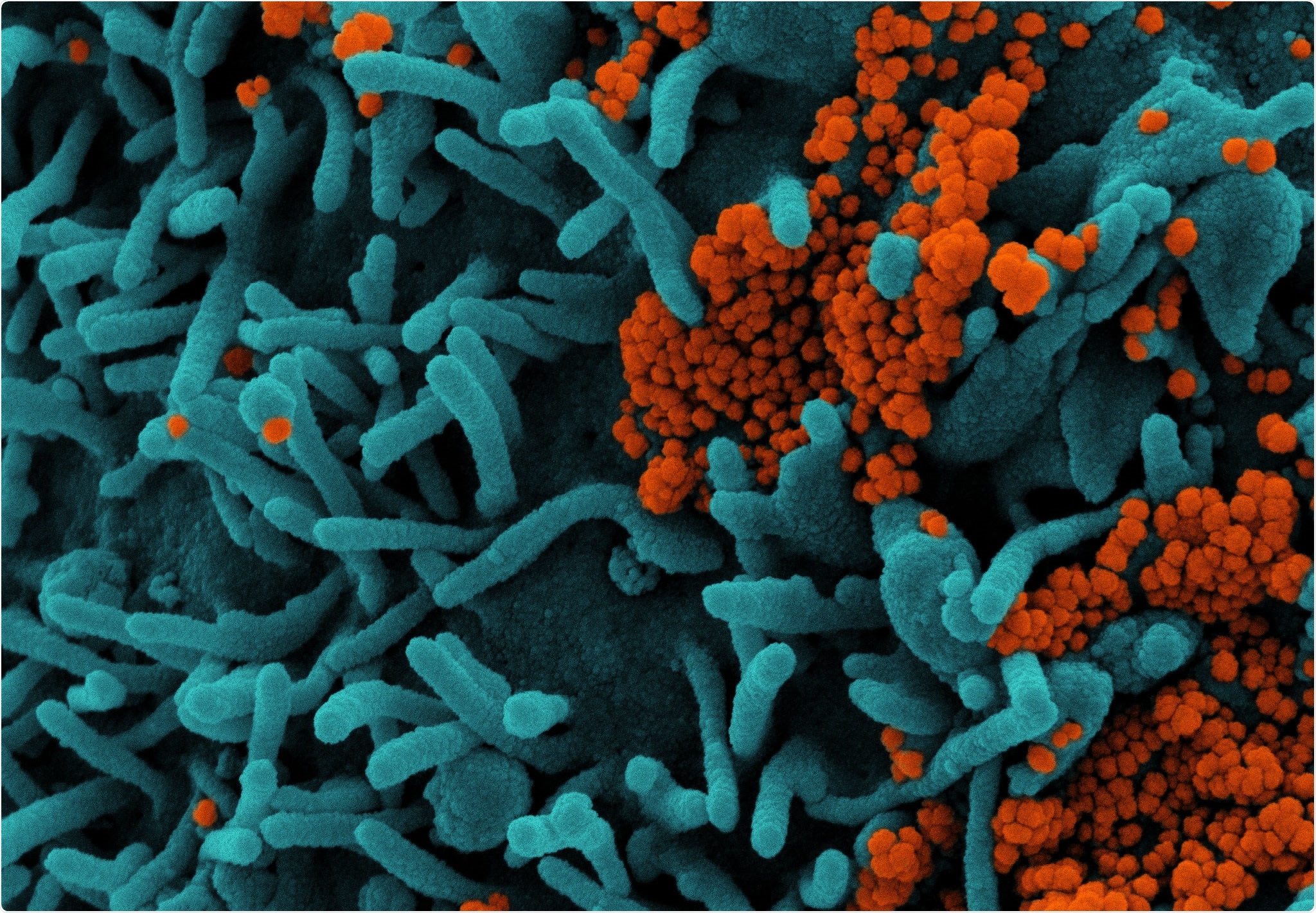 Study: Higher serological responses and increased vaccine effectiveness demonstrate the value of extended vaccine schedules in combatting COVID-19 in England. Image Credit: NIAID