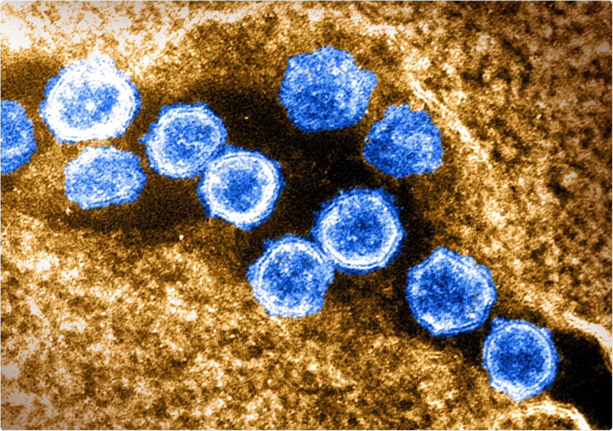 Study: Structure of a germline-like human antibody defines a neutralizing epitope on the SARS-CoV-2 spike NTD. Image Credit: NIAID