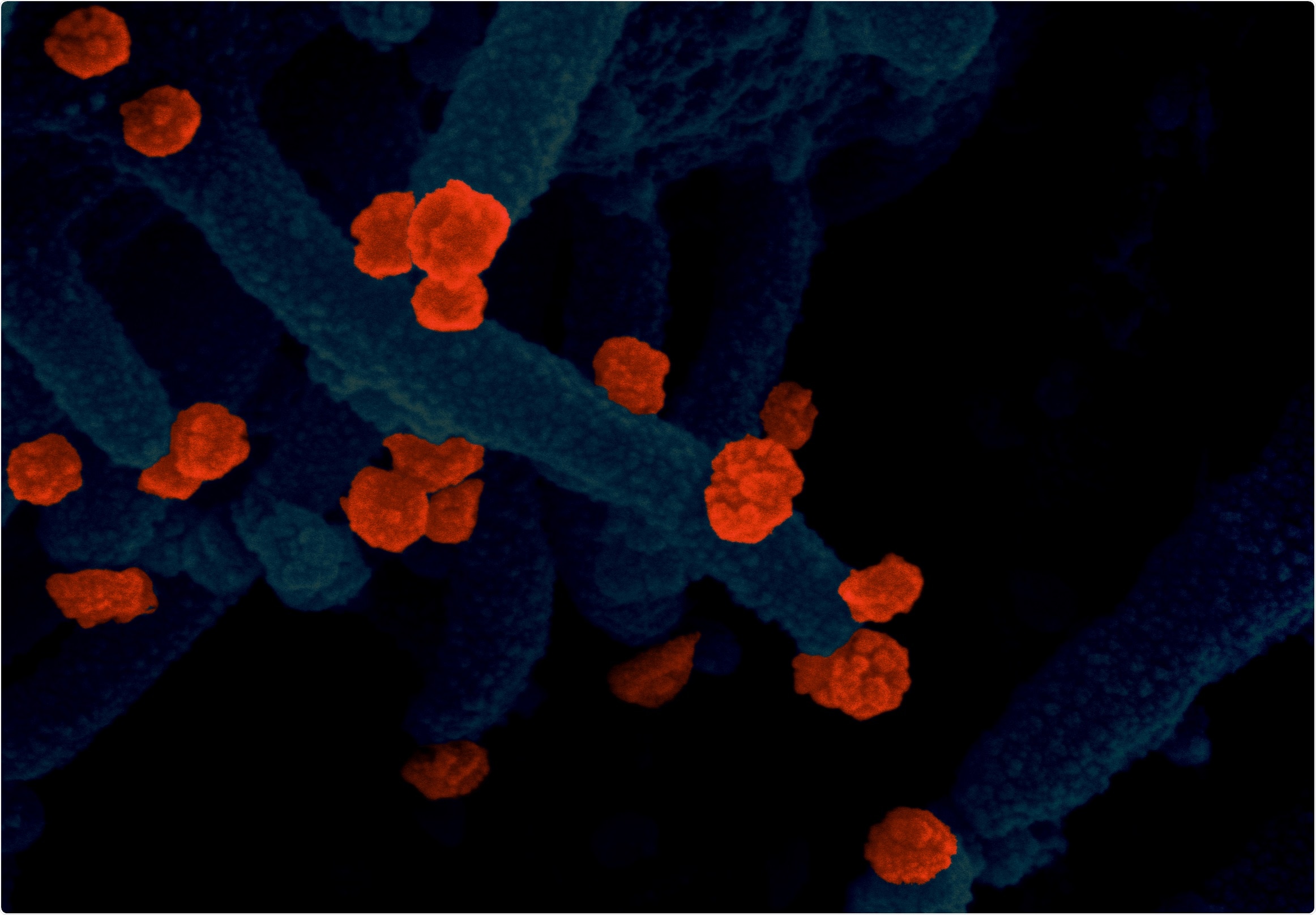 Study: Key substitutions in the spike protein of SARS-CoV-2 variants can predict resistance to monoclonal antibodies, but other substitutions can modify the effects. Image Credit: NIAID