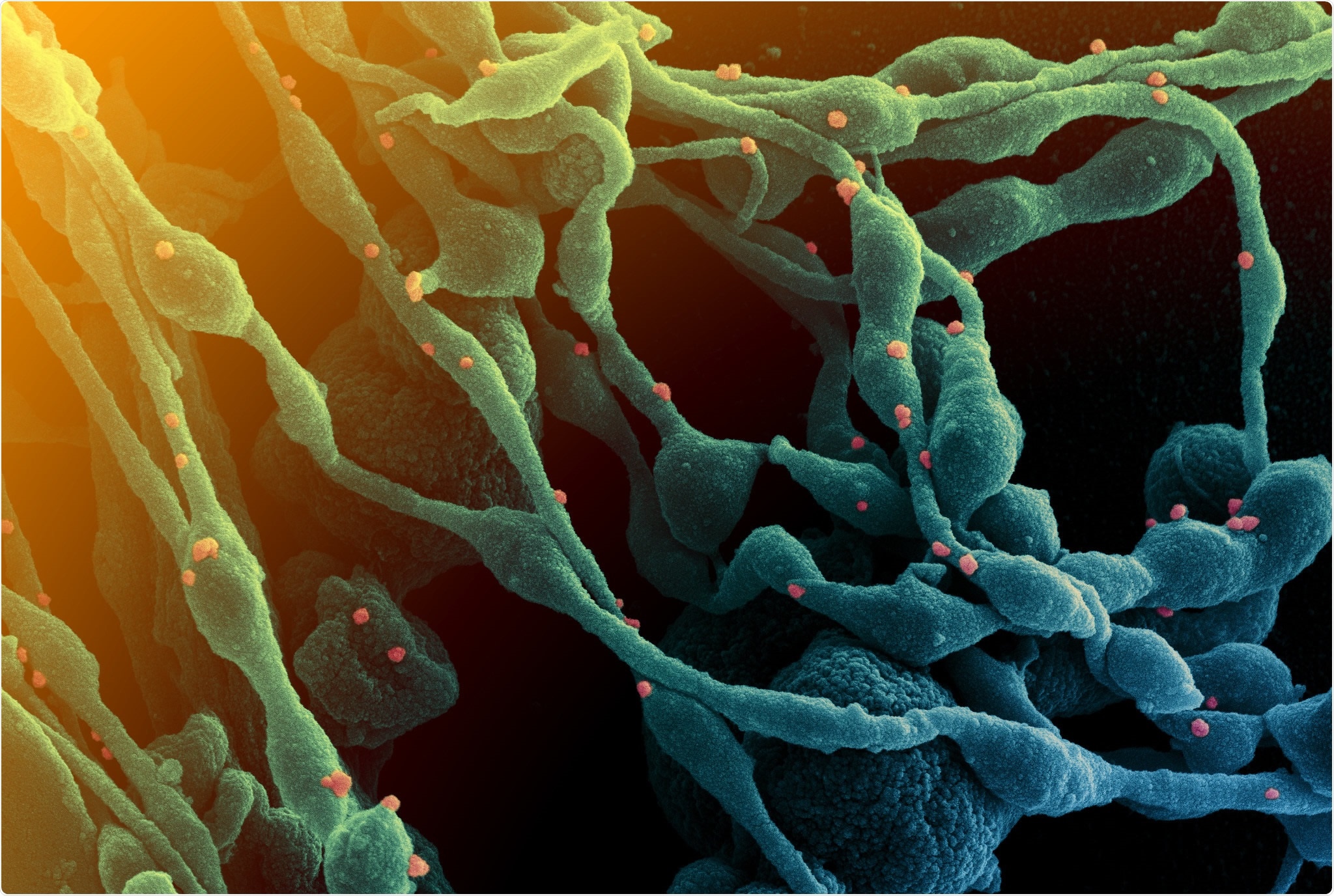 Study: Mitigation of SARS-CoV-2 Transmission at a Large Public University. Image Credit: NIAID