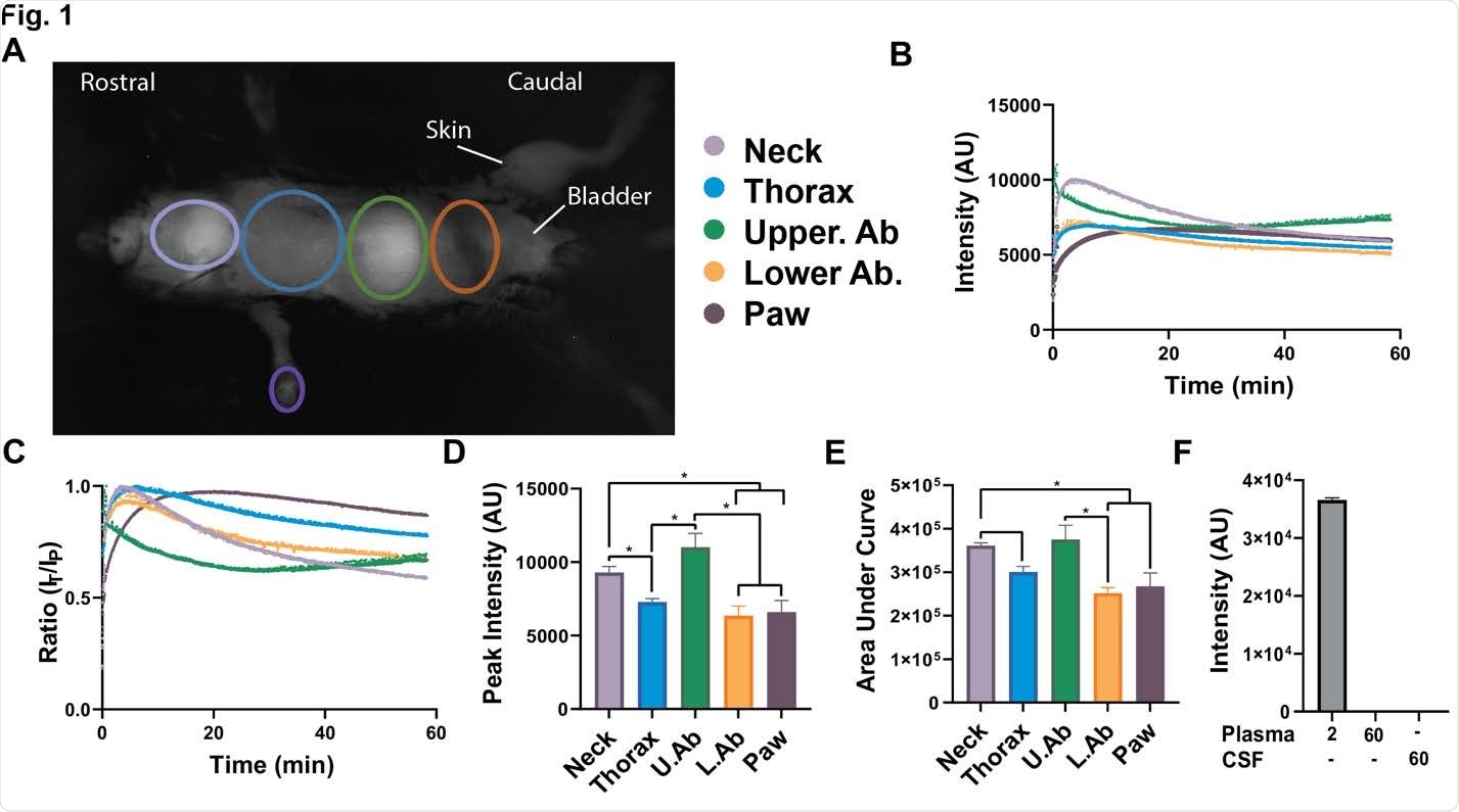 Body-wide biodistribution and slow elimination of a SP in mice A) External in vivo dynamic SP-NIRF image of a mouse after its intravenous injection (after a few minutes). Regions of interest (ROIs) selected for the analysis. B) Representative SP-NIRF intensity-time profile for each ROI over 60 min. C) Standardization of data by dividing intensities at each time point by the peak intensity (IT/IP ratio). D) Peak intensity for the ROIs. E) Area under the curve (AUC) for the ROIs. Values are mean ± SEM,