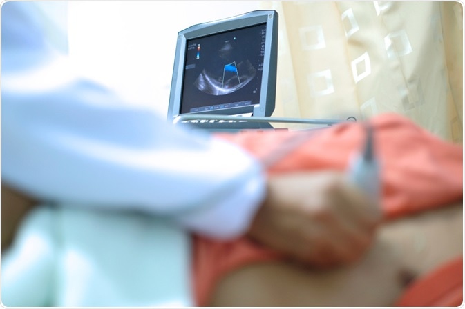 Echocardiography