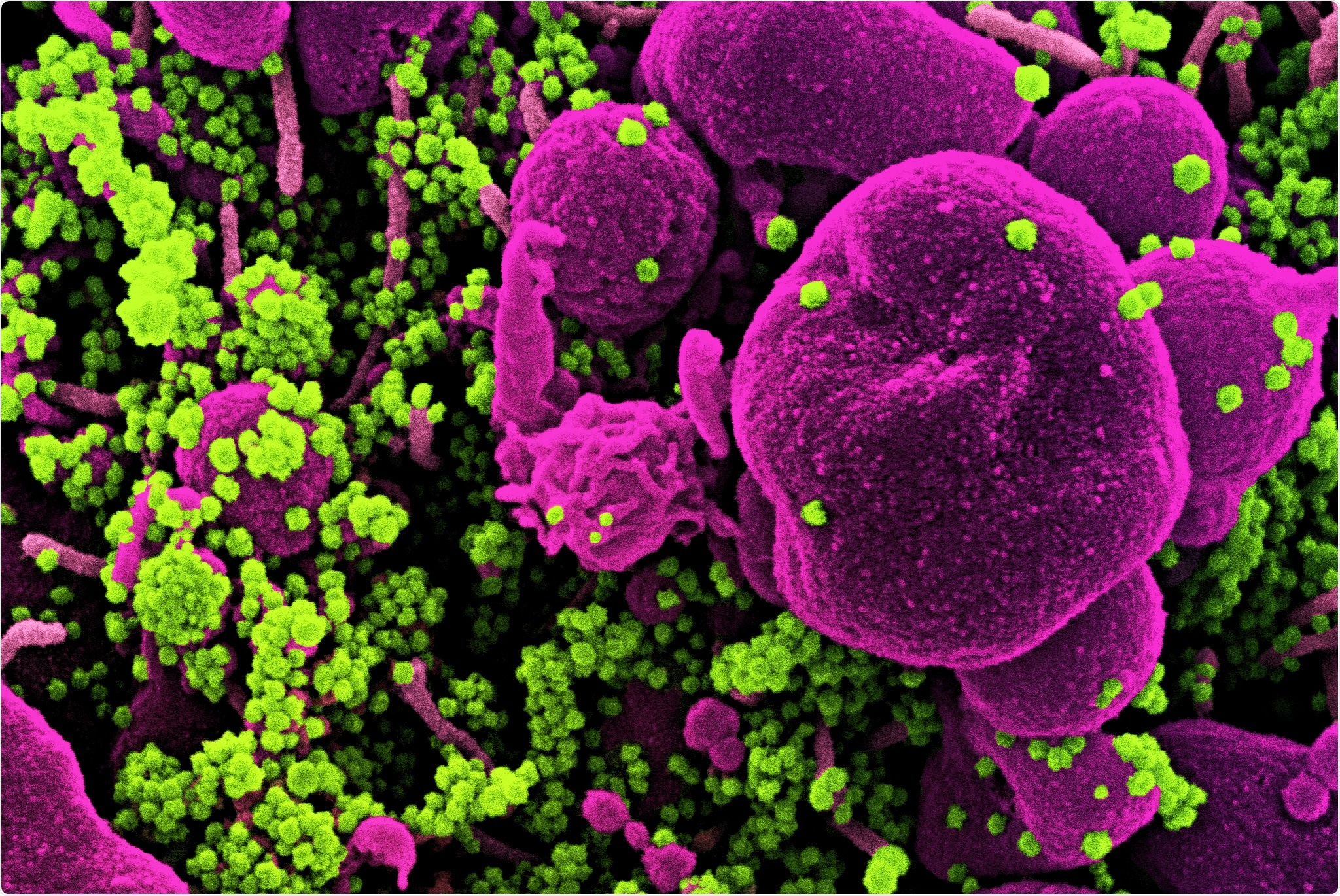 Study: Early versus late third trimester maternal SARS-CoV-2 BNT162b2 mRNA immunization maximizes transplacental antibody transfer and neonatal neutralizing antibody levels. Image Credit: NIAID