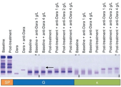 DIRA Plus for the evaluation of patients with serum concentrations of daratumumab above the normal range.
