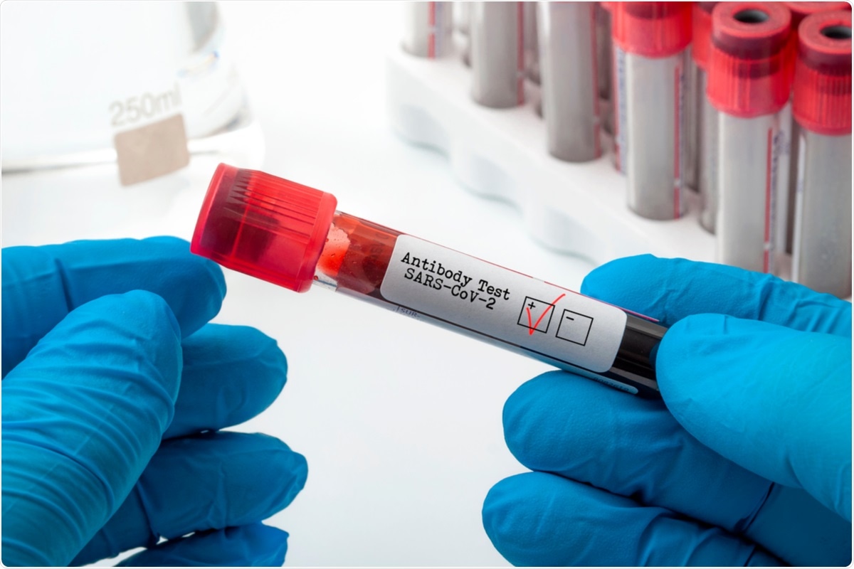 Study: Establishment of human post-vaccination SARS-CoV-2 standard reference sera. Image Credit: Victor Moussa / Shutterstock.com